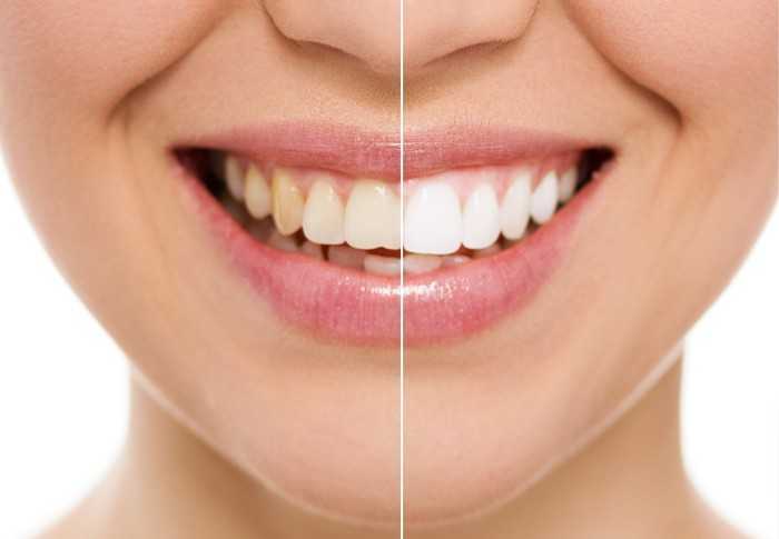 dental implant, chiang mai