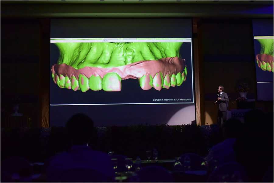 4Dr. Fred Bergmann President of the German society for oral implantology (DGOI) by Dental Chiang Mai