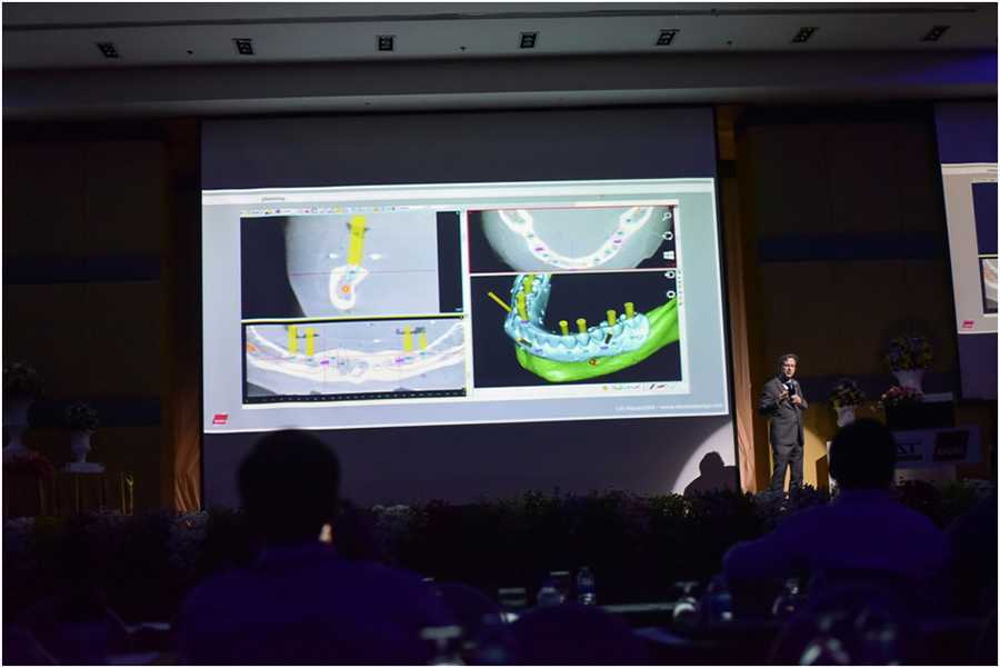 4Dr. Fred Bergmann President of the German society for oral implantology (DGOI) by Dental Chiang Mai