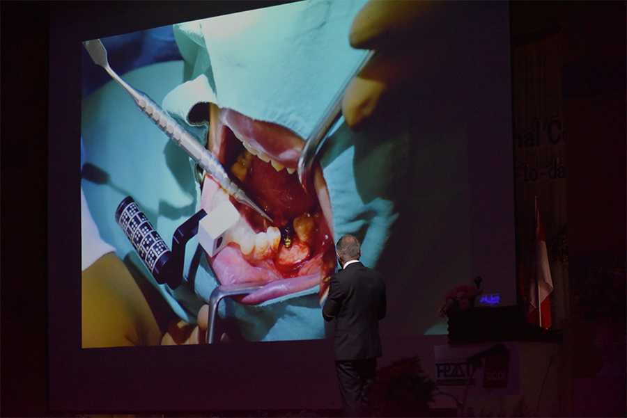 4Dr. Fred Bergmann President of the German society for oral implantology (DGOI) by Dental Chiang Mai