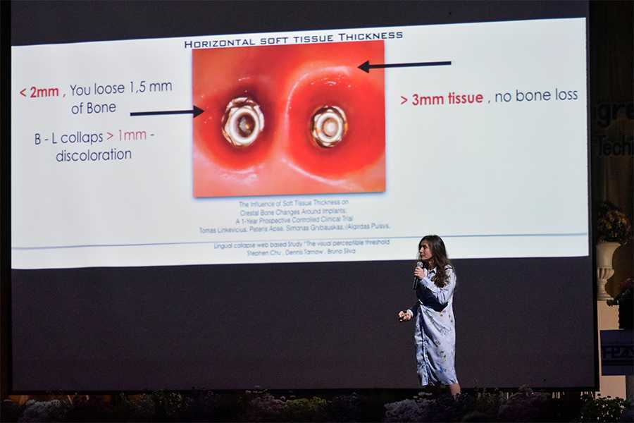 4Dr. Fred Bergmann President of the German society for oral implantology (DGOI) by Dental Chiang Mai
