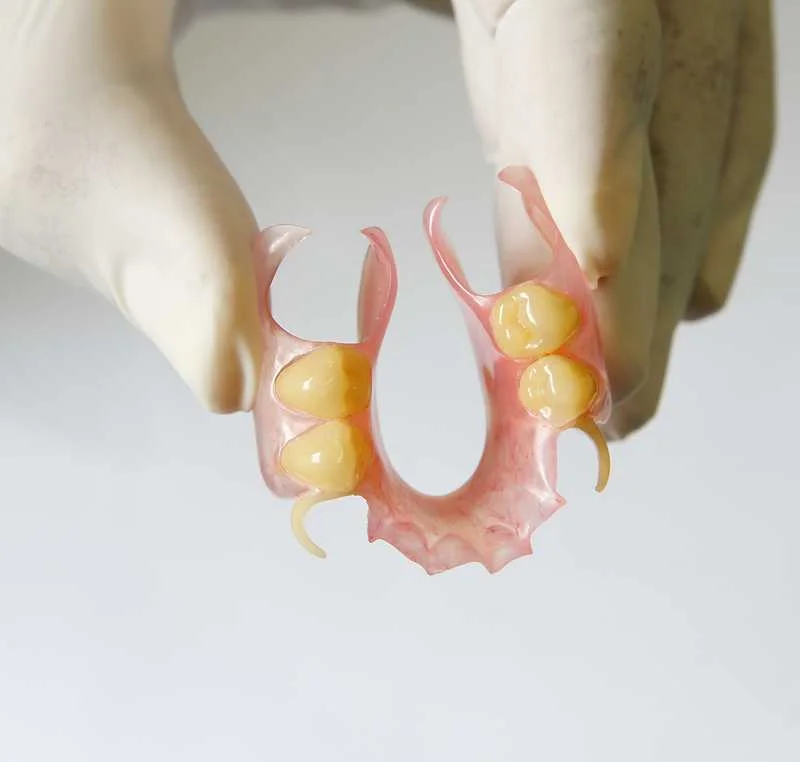 Flexible Denture by Dental Chiang Mai