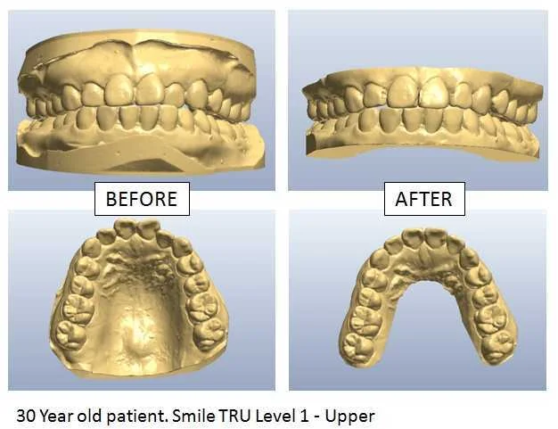 Smile TRU Invisible Orthodontics