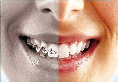 Smile TRU Invisible Orthodontics